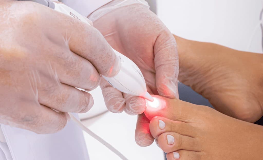 Aplicação de laserterapia em consultório, procedimento não invasivo